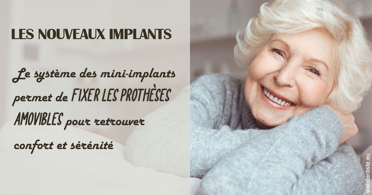 https://www.dentaire-carnot.com/Les nouveaux implants 1