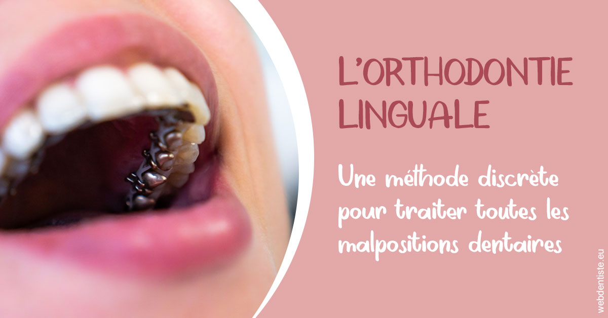 https://www.dentaire-carnot.com/L'orthodontie linguale 2