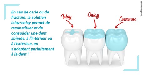 https://www.dentaire-carnot.com/L'INLAY ou l'ONLAY