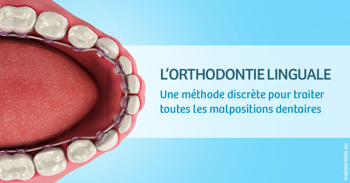 https://www.dentaire-carnot.com/L'orthodontie linguale 1
