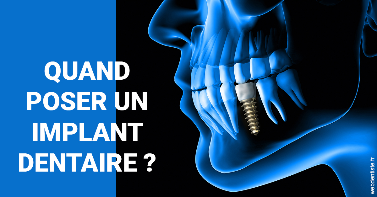 https://www.dentaire-carnot.com/Les implants 1