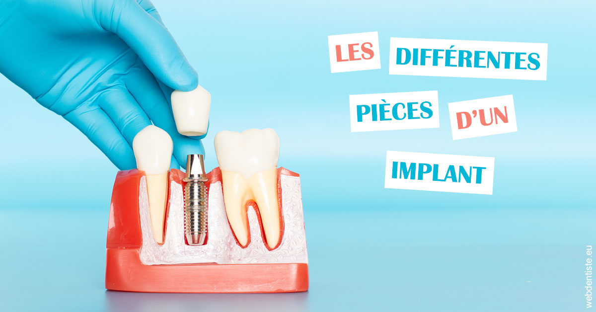 https://www.dentaire-carnot.com/Les différentes pièces d’un implant 2