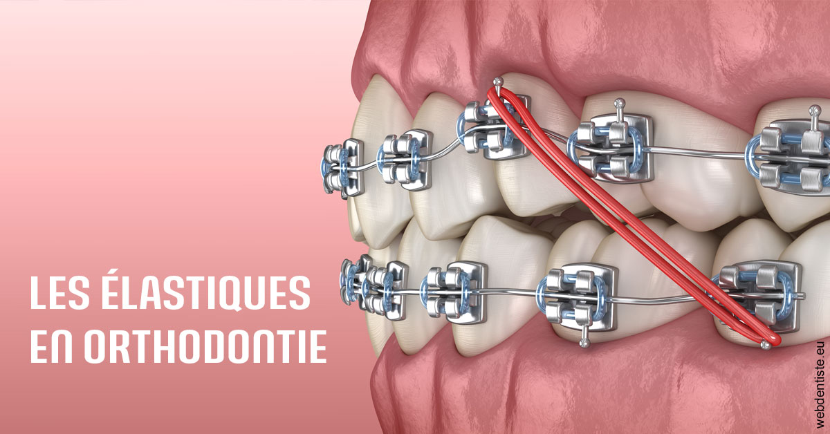 https://www.dentaire-carnot.com/Elastiques orthodontie 2