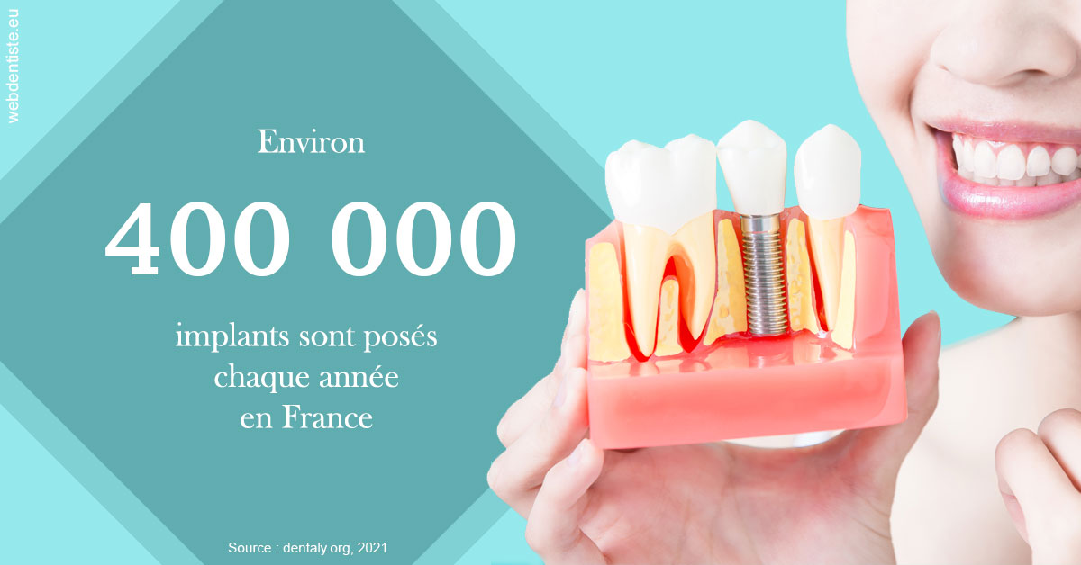 https://www.dentaire-carnot.com/Pose d'implants en France 2