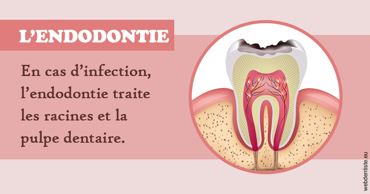 https://www.dentaire-carnot.com/L'endodontie 2