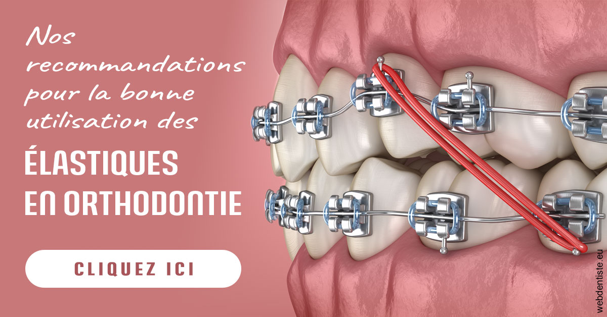 https://www.dentaire-carnot.com/Elastiques orthodontie 2